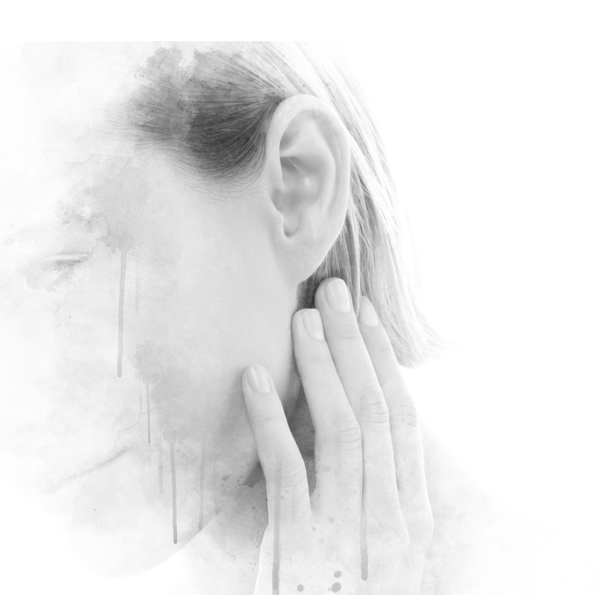 Otoplasty