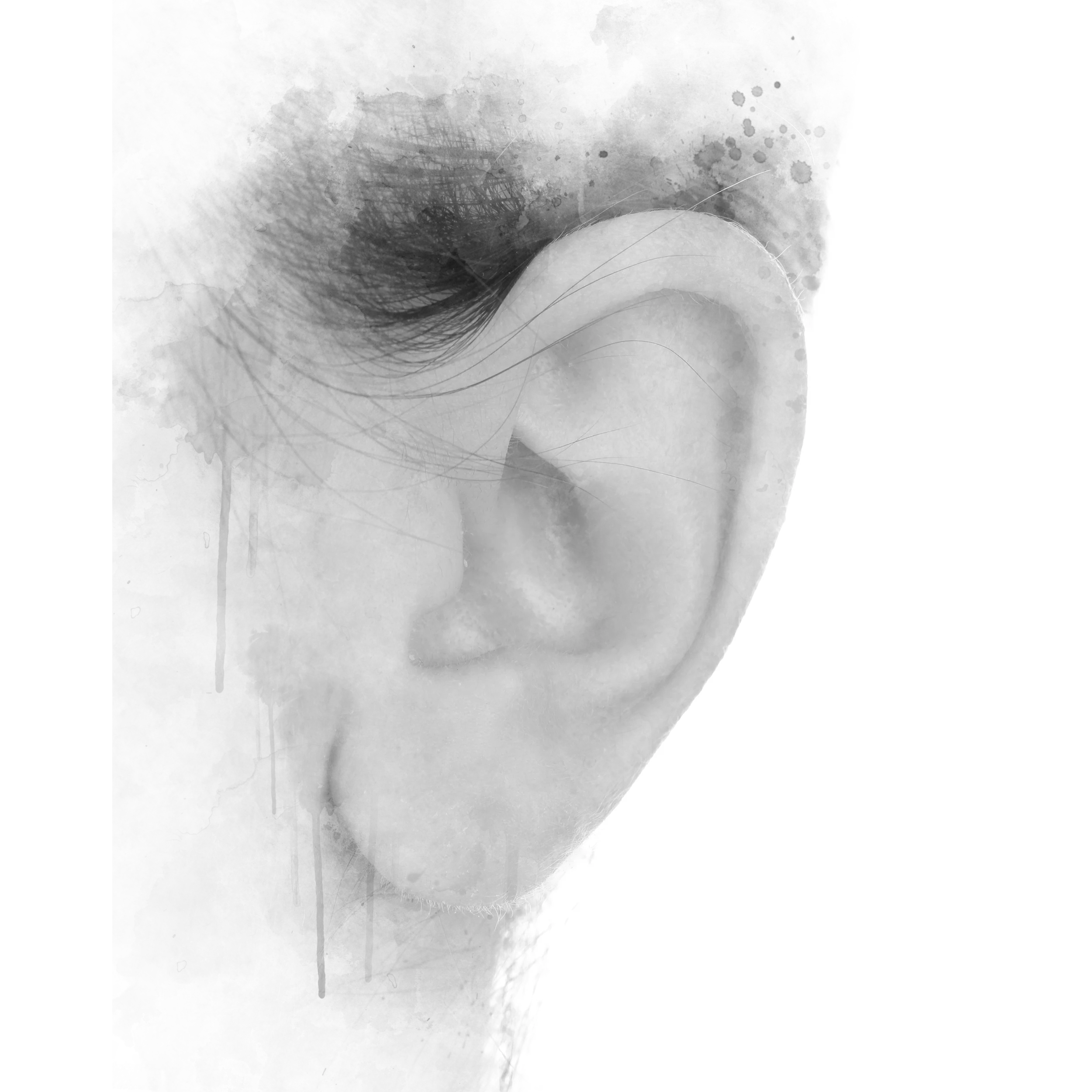 Ear Reconstruction