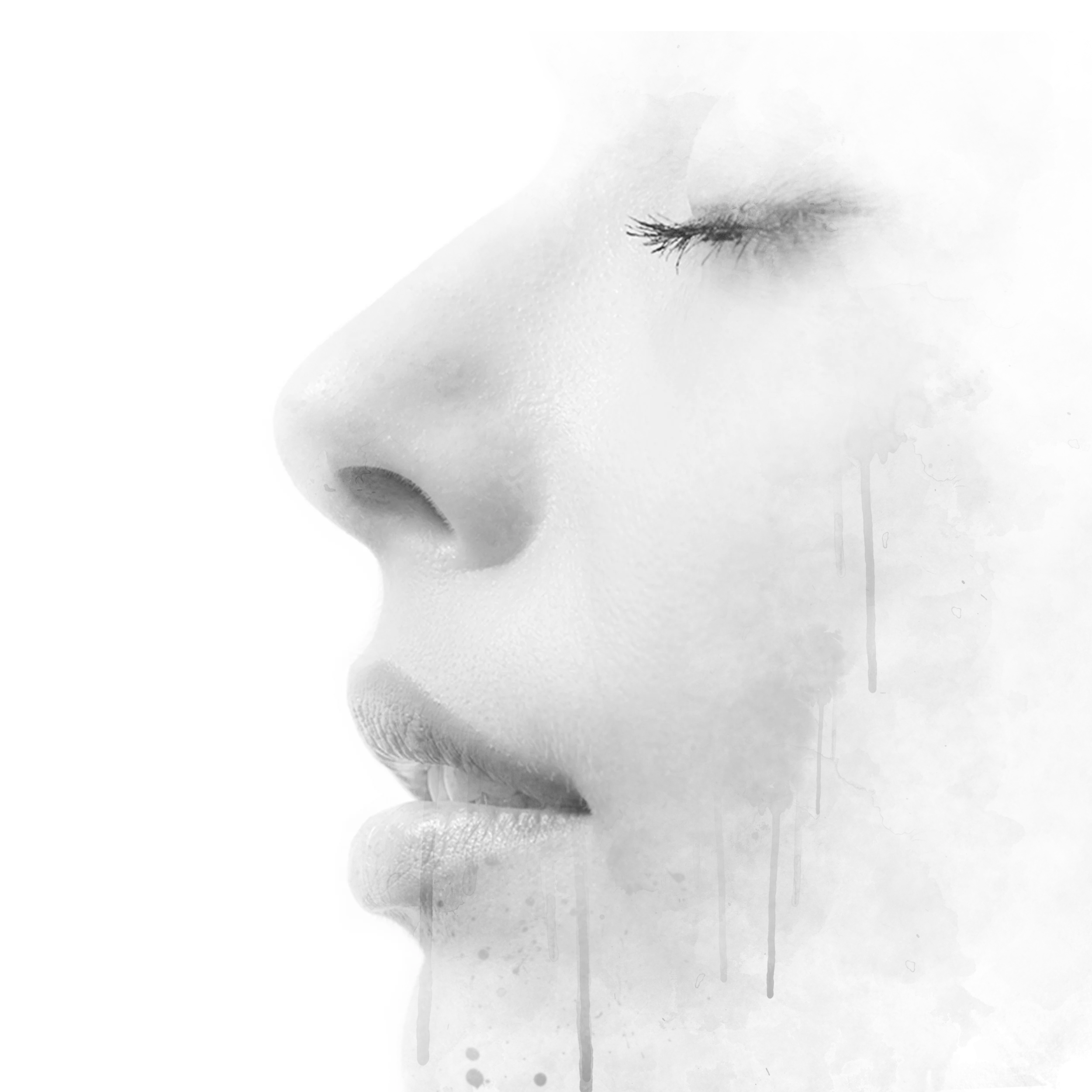 Nasal Reconstruction